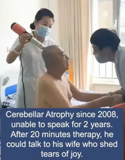 Cerebellar Atrophy treated with Terahertz wand