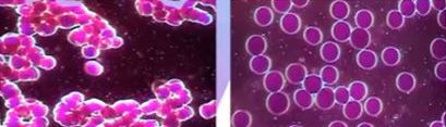 Dark Field Blood before and after terahertz charged water