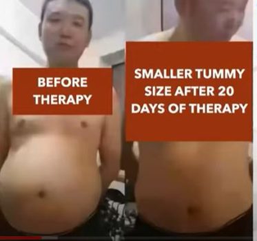 Fat stomach reduction with terahertz wand